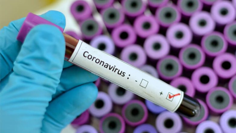 Coronavirus förklarat: Symtom och förebyggande av COVID-19